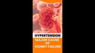 Why is high blood pressure damaging to the kidneys? High blood pressure and the Kidneys Major Cause