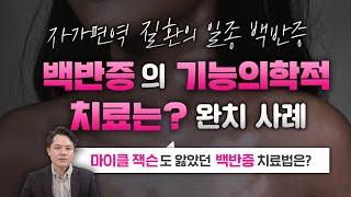 마이클잭슨도 앓았던 백반증의 기능의학적 치료는?