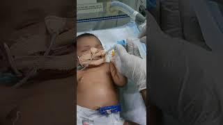 NICU baby tube saction #motivation #video #virals #nursing work #gnm