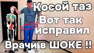 Врачи в ШОКЕ! Я исправил КОСОЙ ТАЗ и теперь порхаю как бабочка и жаль что я не знал раньше