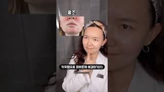 약국템으로 피부고민 해결하기(1)