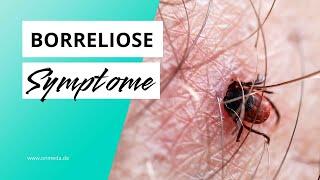 Das sind Warnzeichen einer Borreliose