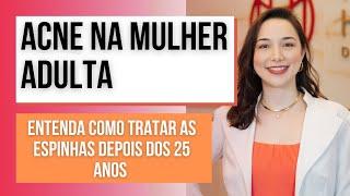 ACNE na mulher Adulta: Entenda como tratar cravos e espinhas depois dos 25 anos| Dra. Marina