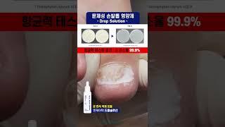 [엔케어텍] 문제성손발톱영양제 드롭솔루션 /드롭솔루션D / 무좀관리제품