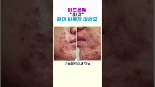 여드름에 이것️바르면 절대안됩니다ㅣ여드름 닥터 #여드름 #여드름스킨케어 #여드름관리 #여드름케어