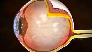 HCL Learning DigiSchool - The Human Eye