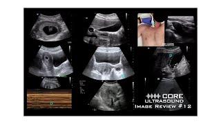 Core Ultrasound Image Review #12!