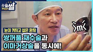 [열린수신함] 수술HAN썰_눈이 커지고 싶은 30대 초반 여성환자 - "쌍꺼풀재수술과 이마거상술"