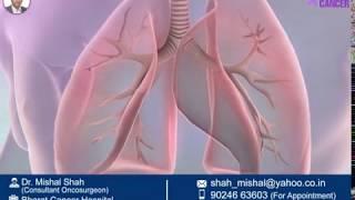 Treatment options of Lung Cancer