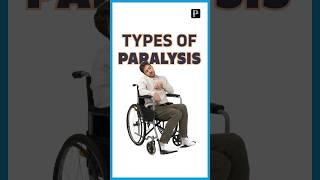 5 Types of Paralysis