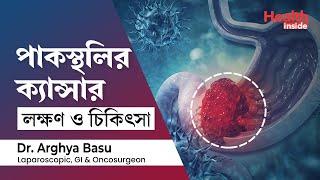 পাকস্থলীর ক্যান্সারের লক্ষণ, কারণ ও চিকিৎসা | Stomach Cancer Symptoms, Causes & treatment in Bengali