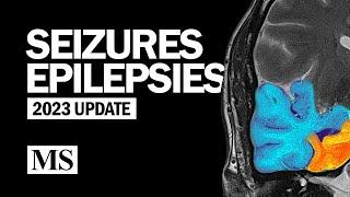 Seizures and Epilepsies (2023)