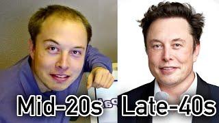 Elon Musk Hair Transplant EXPOSED