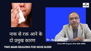 Two main reason for nose bleed | Nakseer | Nose bleed | Epistaxis