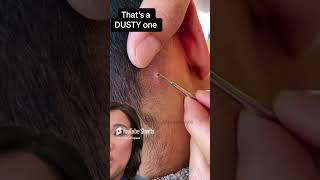 Terminal Hair in Scalp