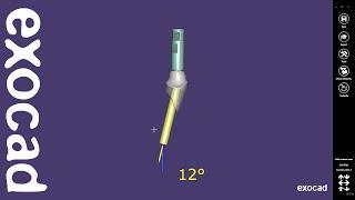 exocad Quick Guide: Angulated Screw Channel