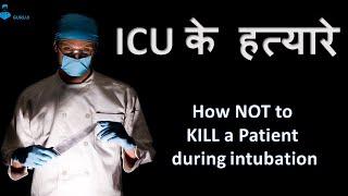 How to intubate a Hypotensive patient in ICU