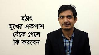 বেলস পালসির চিকিৎসা বা ব্যায়াম/ মুখ বাঁকা রোগের চিকিৎসা  / Bell`s palsy excise Bangla , BD