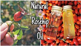 How To Make Rosehip Oil - Easily Step By Step 