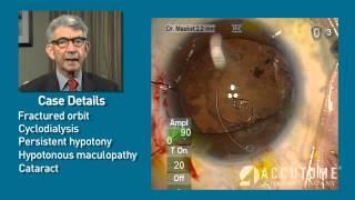 Applications of the Ultrasound Biomicroscopy