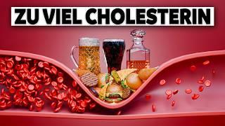 Cholesterin senken: Top 5 Lebensmittel (Wenig bekannt)