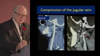 Fraser Henderson Neurological Manifestations of Hereditary Hypermobility Connective Tissue Disorders