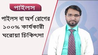 মেডিসিন ছাড়াই অর্শ বা পাইলসের ঘরোয়া চিকিৎসা - Dr Hakim Foridujjaman