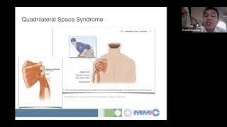 Dr. Franklin Domingo lecture on Ultrasound guided procedure for Neuropathic Pain on the Shoulder