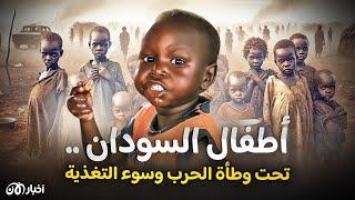 أطفال السودان تحت وطأة الحرب وسوء التغذية