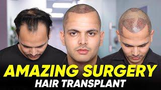 Hair Transplant in Ahmedabad | Best Results & Cost of Hair Transplant in Ahmedabad