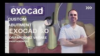 how to design custom abutment with exocad3.0 (part2)