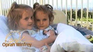 The Conjoined Twins Who Miraculously Survived Separation Surgery | The Oprah Winfrey Show | OWN