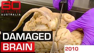 Dissecting an athlete's brain to determine the real impact of contact sports | 60 Minutes Australia