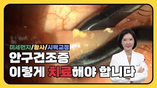 안구건조증 증상부터 치료까지 이 영상으로 한 번에 해결하세요