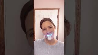 Easy All-In-1 Whitening System - MySmile Teeth Whitening Kit for Sensitive Teeth with LED Light