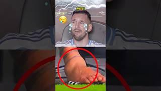 Messi VS Ronaldo VS Neymar VS Dias | Tragic Injury Moments