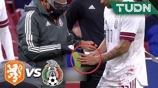 ¿Qué le pasó? ¡APARATOSA lesión de Govea! | Holanda 0-1 México | Amistoso 2020 | TUDN