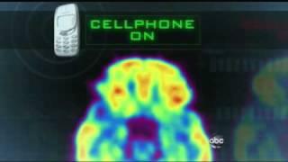 Cell Phones Mysterious Effects on the Brain 2/22/2011