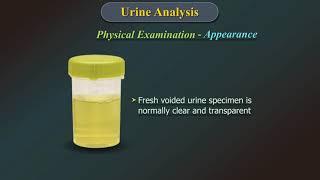 Urine Analysis