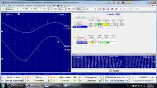 Guía de Funcionamiento del Electromiógrafo Natus Viasys Teca Synergy