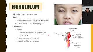 ติวNL EYE