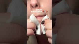 ДАВИТЬ ИЛИ НЕТ? сыворотка: 142054898 #воспаления #гигиена #кожа #уход РП