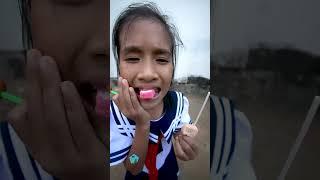 Em gái ham Ăn Kẹo Mút bị Bác Sĩ Nhổ Răng #keomut