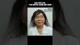 인생 2막의 시작, 74세 안면거상 생생한 변화 이야기