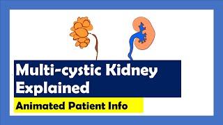 Multi-cystic Dysplastic Kidneys explained... animated patient info