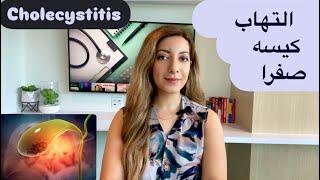 التهاب کیسه صفرا (نشانه ها، علت، تشخیص، درمان)/cholecystitis/کوله سیستیت