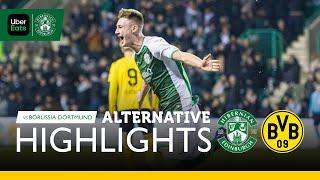 Hibernian 1 Borussia Dortmund 2 | Alternative Angle Highlights | UEFA Youth League