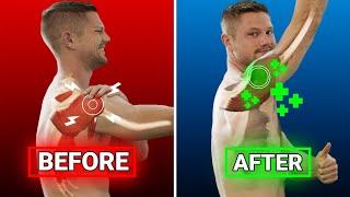 The Stupidly Simple Shoulder Pain Fix (instant results)