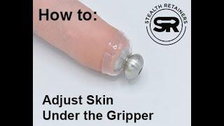 How to Adjust Skin Under Your Retainer