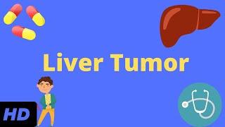 Liver Tumor, Causes, Signs and Symptoms, Diagnosis and Treatment.